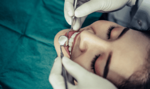 Dentist applying dental filling to patient's tooth during treatment procedure.