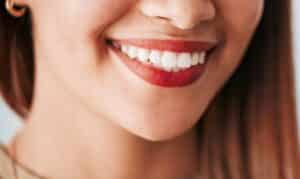Woman with bright white teeth smiling, showing results of professional teeth whitening treatment.