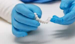 Dentist in blue gloves holding dental crown restoration during placement procedure.