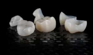 Broken eggshell fragments representing dental crown restoration on dark background.