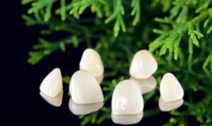 Six tooth-colored dental veneers displayed next to green foliage before application.