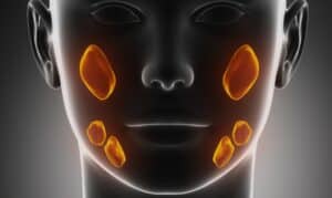 Medical illustration showing inflamed salivary glands highlighted in orange on a patient's face and jaw.
