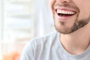 Man with bright white teeth smiling, demonstrating professional teeth whitening results.