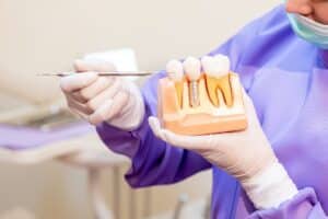 Dentist examining dental implant model with demonstration tool to explain post-implant care.