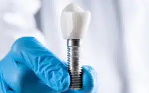 Dental implant prosthetic crown held in gloved hand showing titanium screw component.