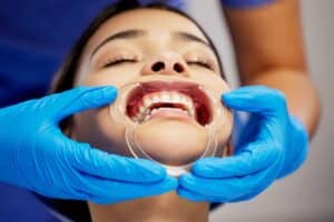 Dentist examining patient's teeth with mouth retractor during dental exam.