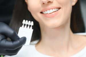 Woman smiling while holding porcelain veneer shade guide samples for tooth color matching.