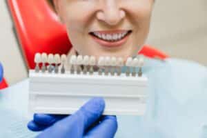 Dentist holding tooth shade guide showing veneer color options for patient smile consultation.