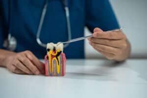 Dentist pointing to tooth decay layers on a dental model to explain root canal treatment.