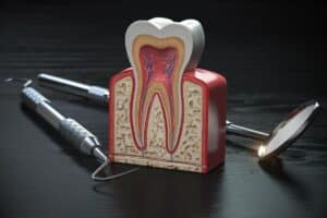 Cross-section diagram of tooth anatomy showing crown, dentin, pulp chamber, and root canals with dental tools.